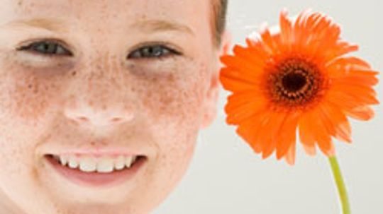 5 Tips for Minimizing Freckles