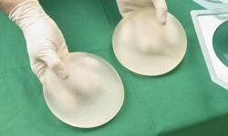 Silicone breast implants