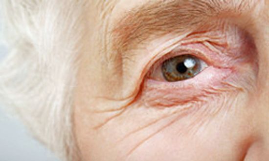 5 Ways Your Skin Changes as You Age