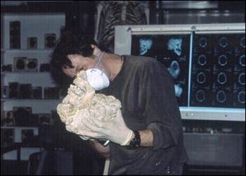 Dr. Thomas Higham drills out a bone fragment from Joseph Merrick's skull for testing.